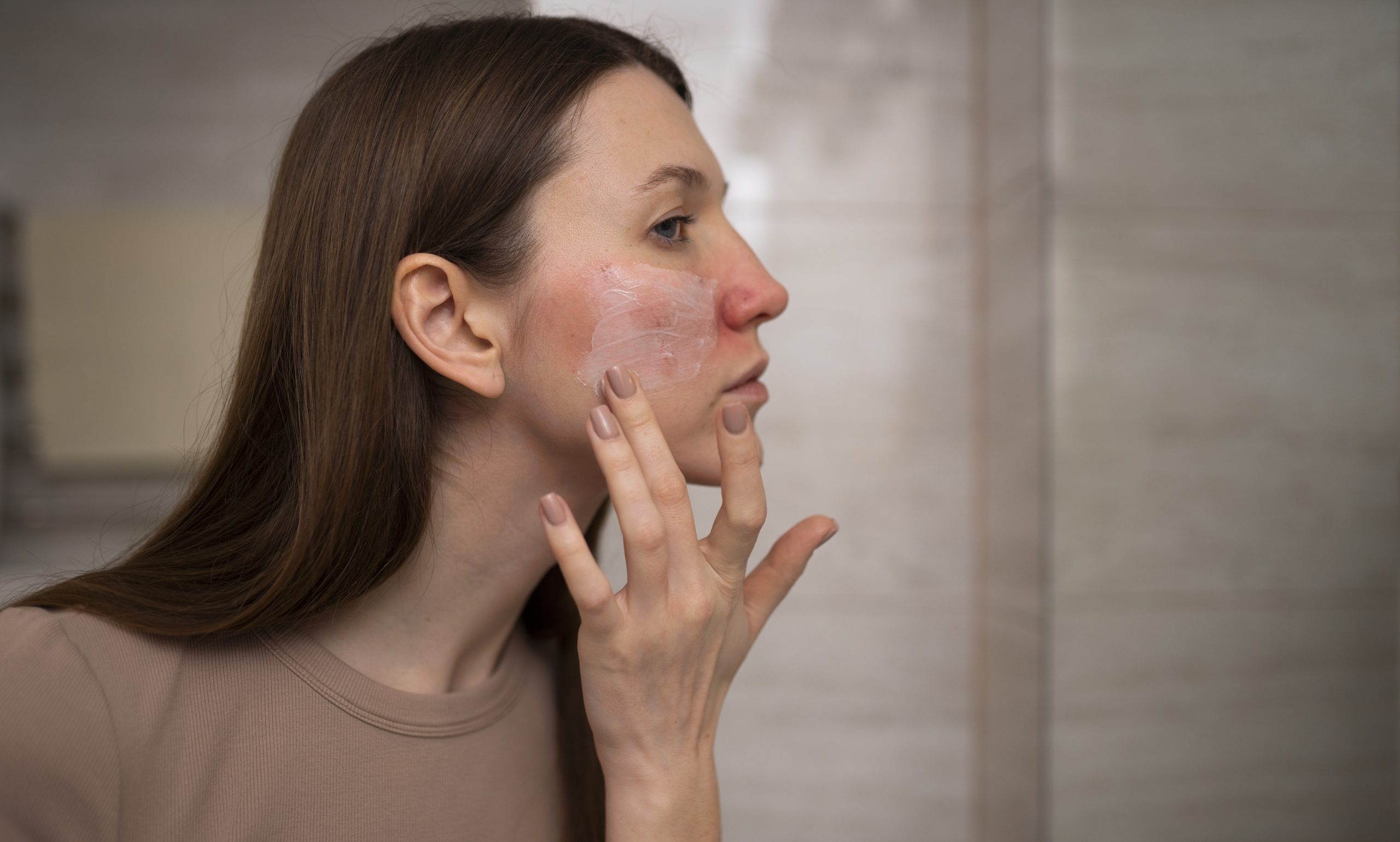 Dermatologist treating skin condition
